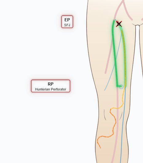 Visualize venous pressure gradients