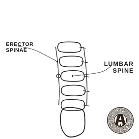 Lower Back Pain explained: Lumbar spine and erector spinae | Achilles Clinic condition guide
