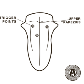 Myofascial Pain and Trigger Points explained: Upper trapezius trigger points | Achilles Clinic condition guide