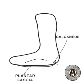 Plantar Fasciitis explained: Plantar fascia and calcaneus, foot in profile | Achilles Clinic condition guide