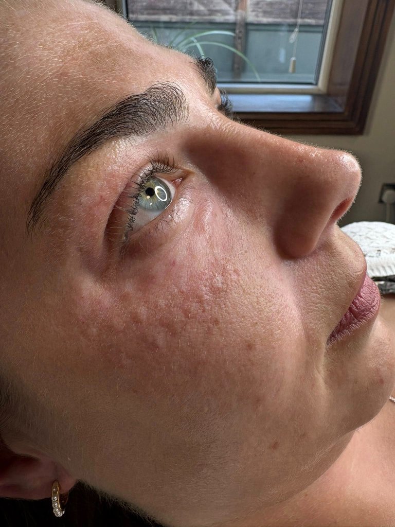 Client result 6