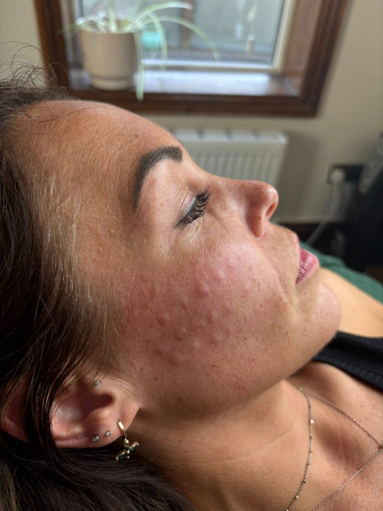 Client result 5
