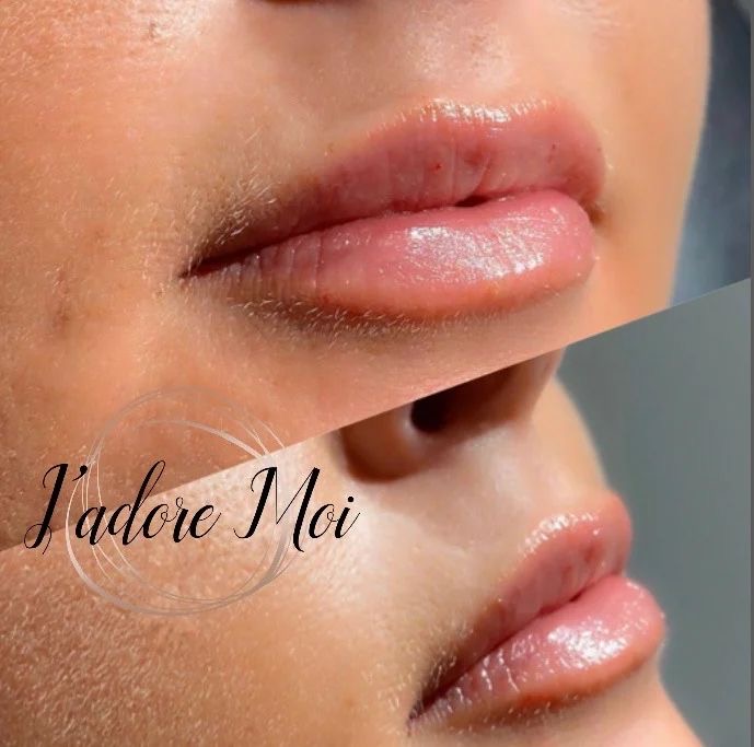 Client result 7