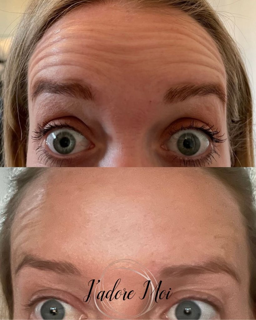 Client result 9