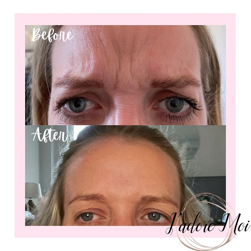 Client result 1