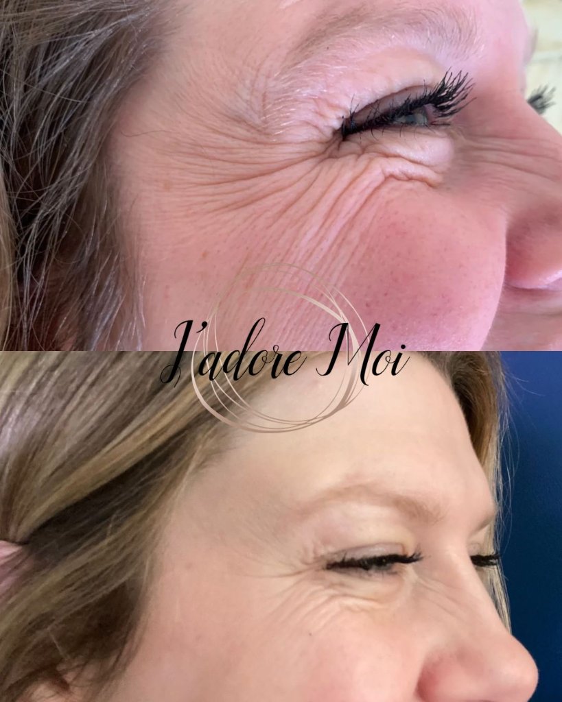 Client result 10