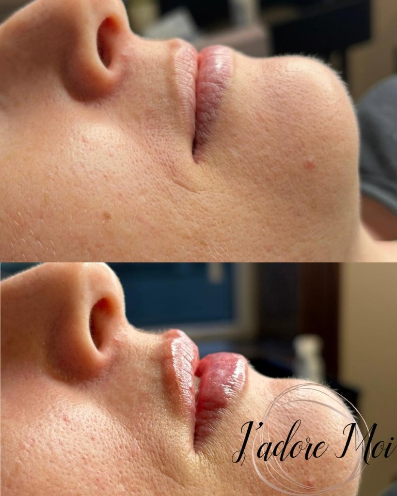 Client result 4