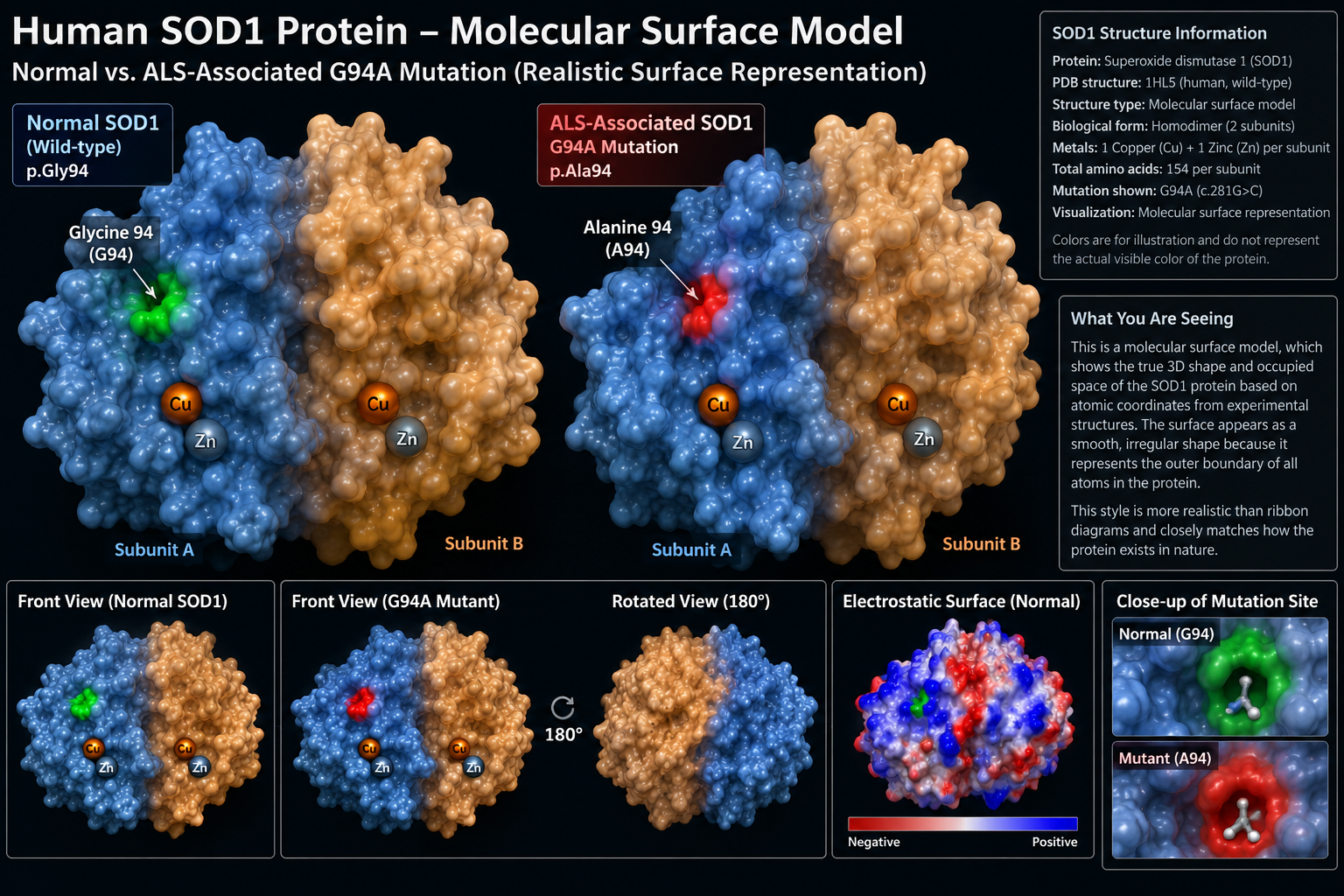 SOD1-Linked ALS — AI-Assisted Variant Comparison — scientific infographic