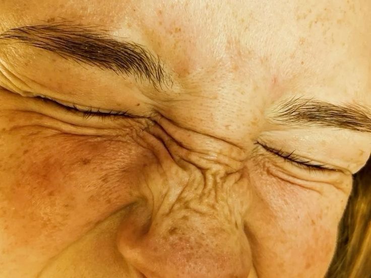 Close-up of a face with eyes scrunched up in the sun