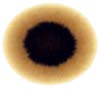 Blotter spot example 5
