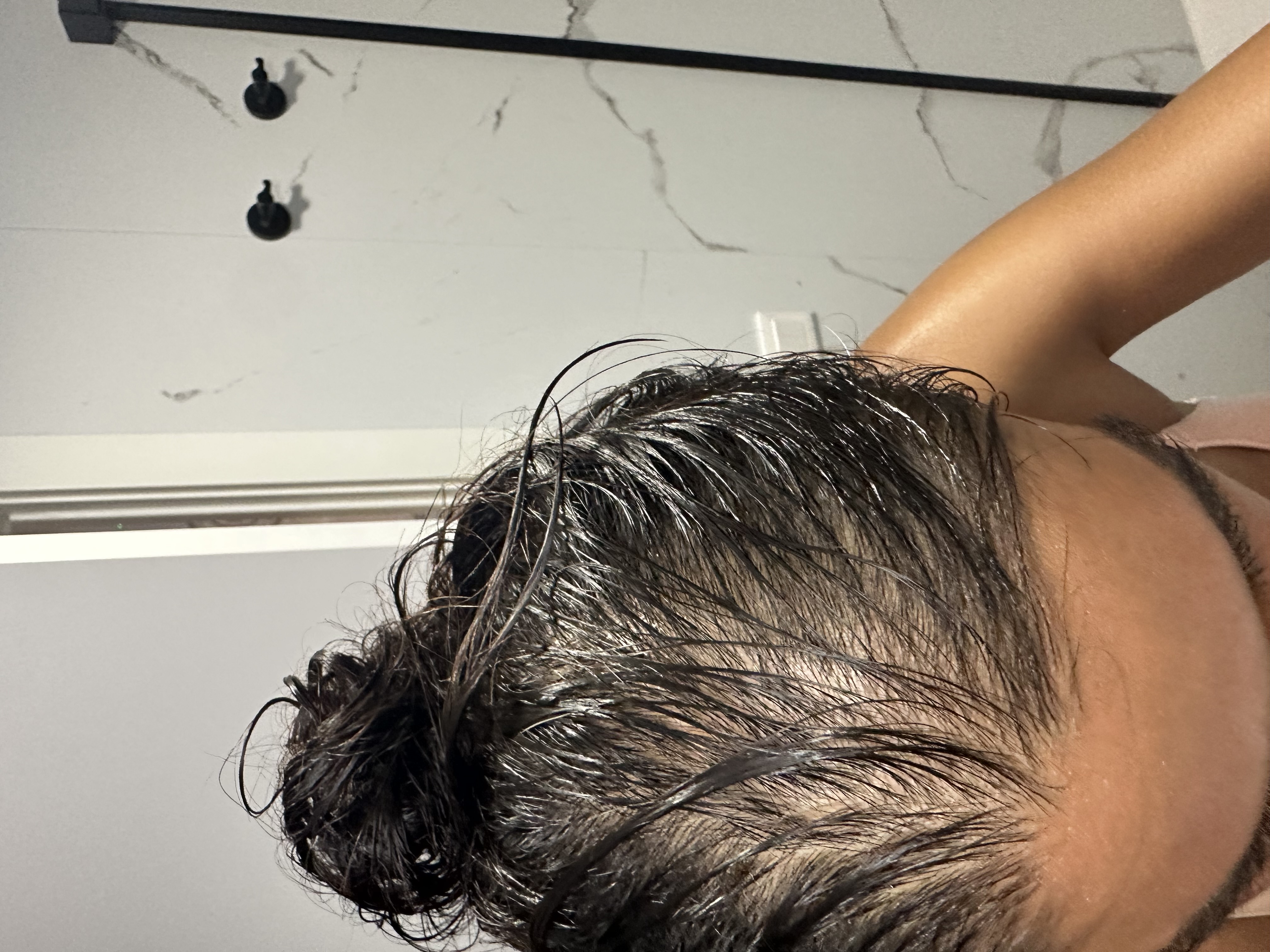 Before — Customer-reported progress after 6 months of Wonder Pill use