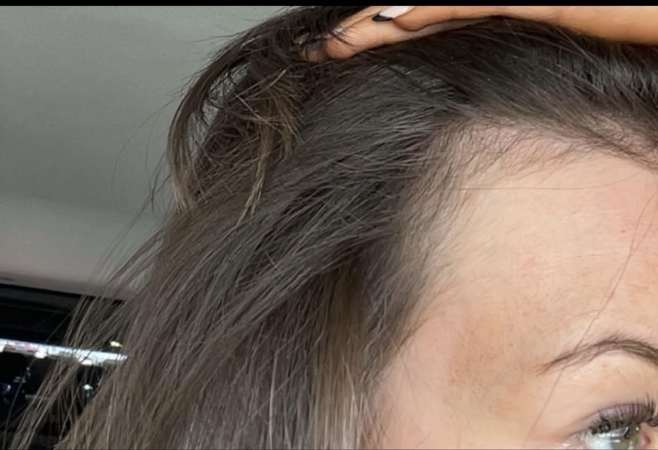 After — Customer-reported progress after 12 weeks (about 3 months) of Wonder Pill use