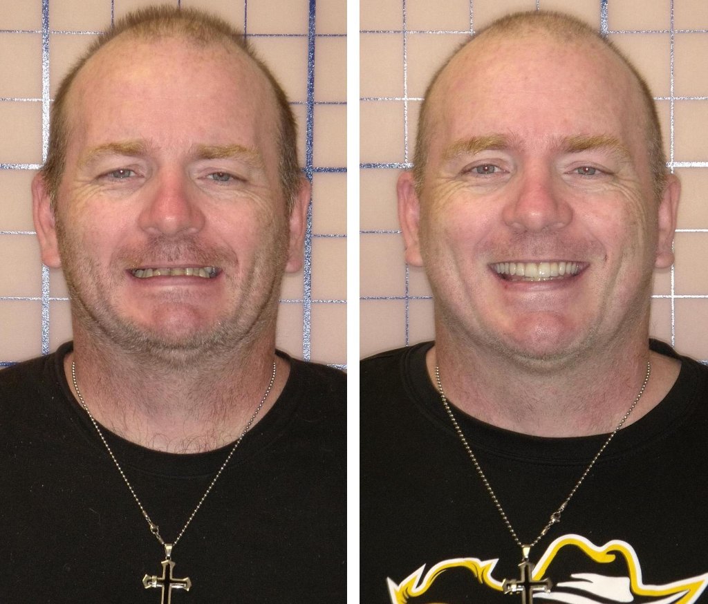 Patient's smile transformation