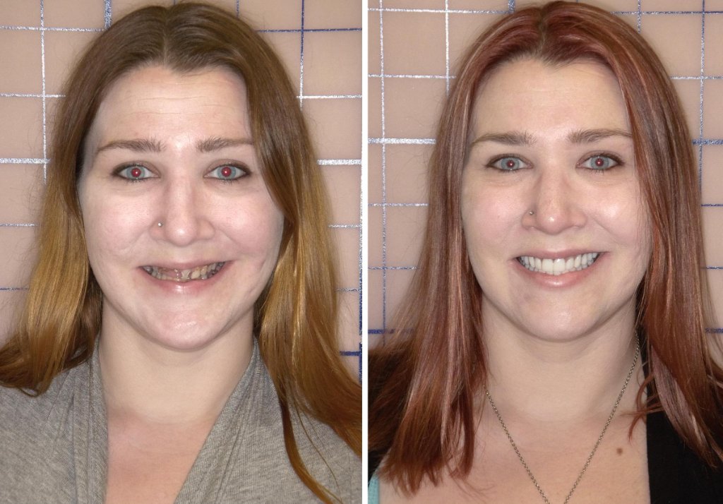 Patient's smile transformation