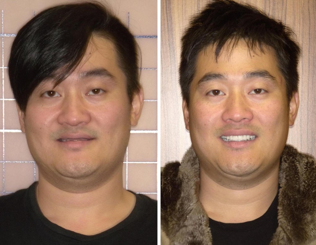 Patient's smile transformation