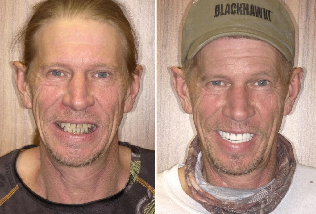 Patient's smile transformation