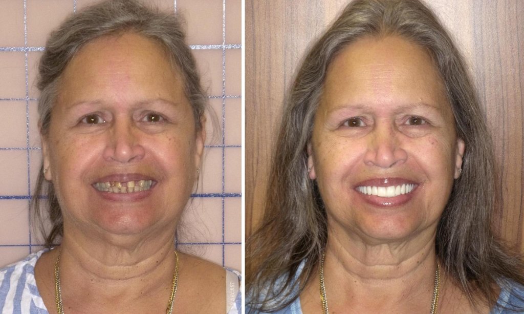 Patient's smile transformation