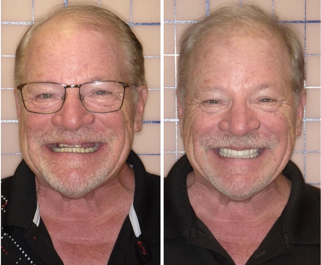 Patient's smile transformation