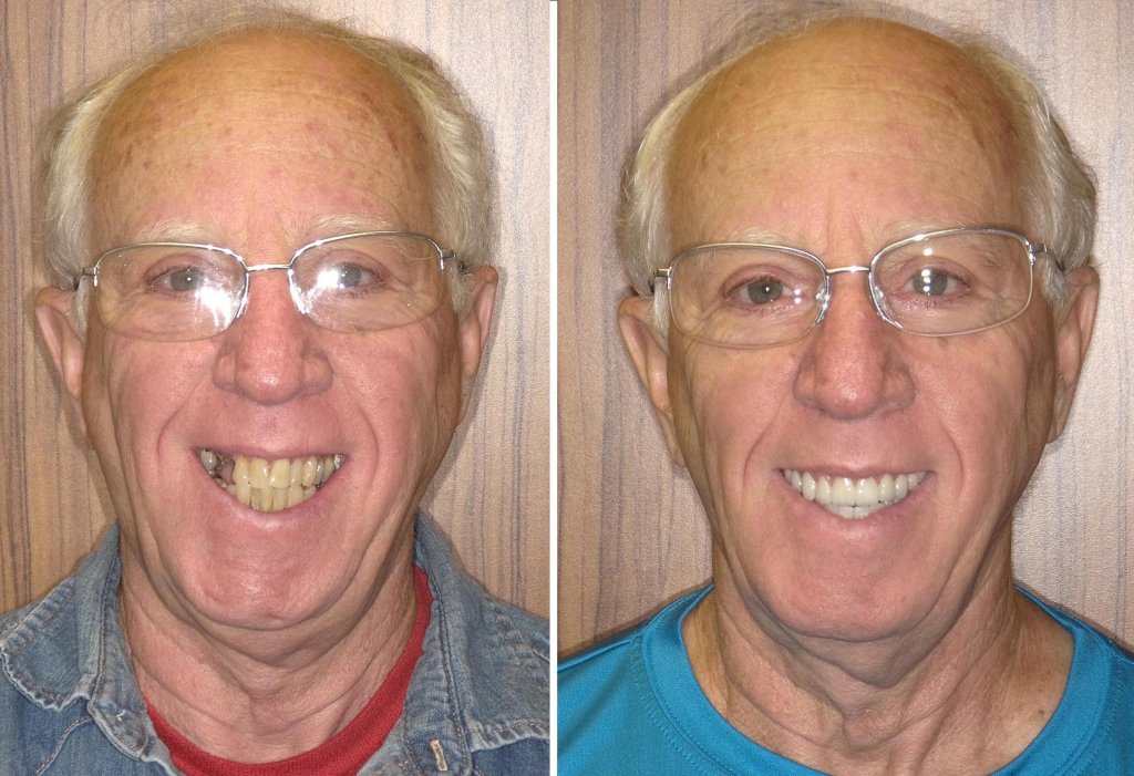 Patient's smile transformation