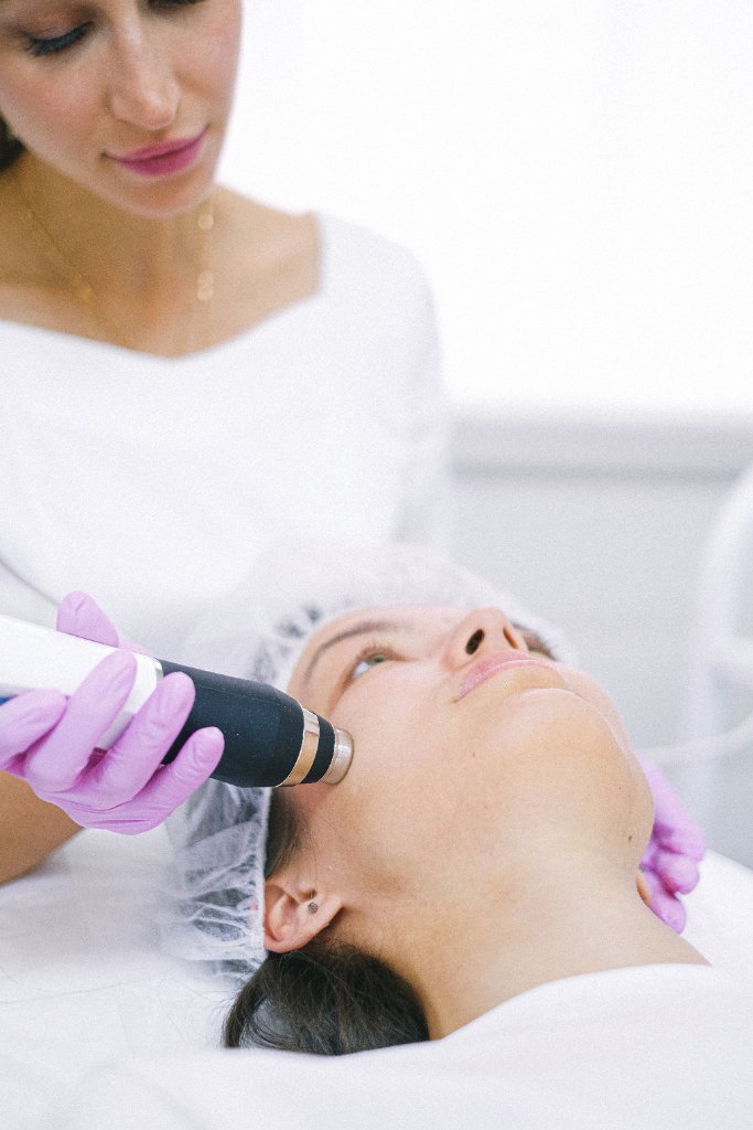 Fractional RF Microneedling
