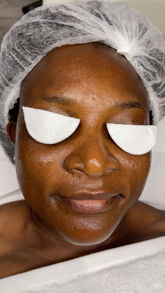Skincare treatment