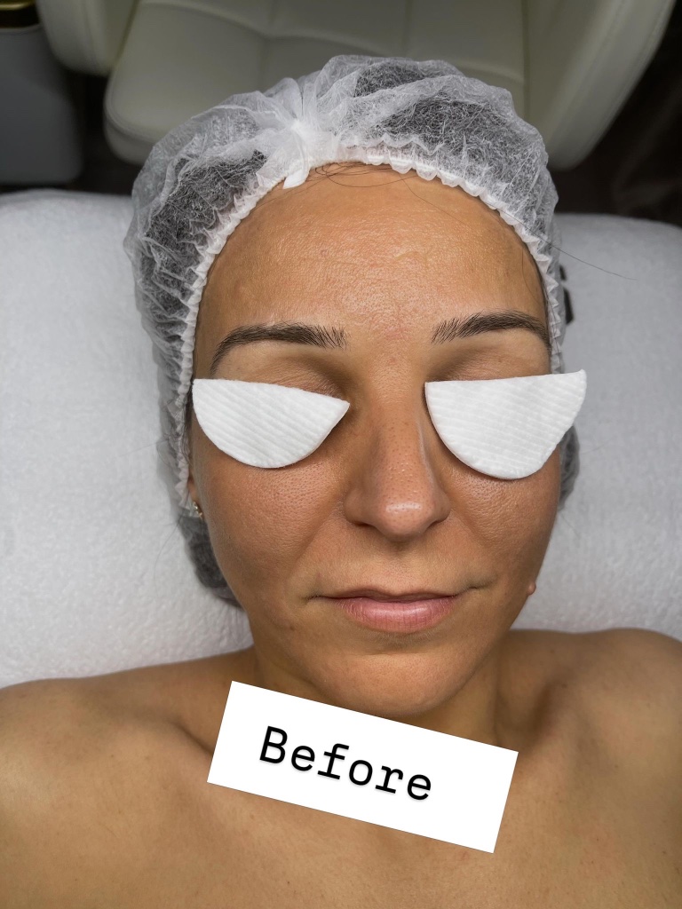 Before facial treatment