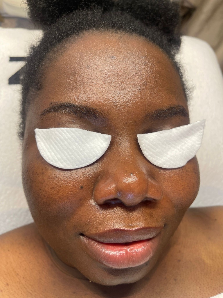 Beauty treatment
