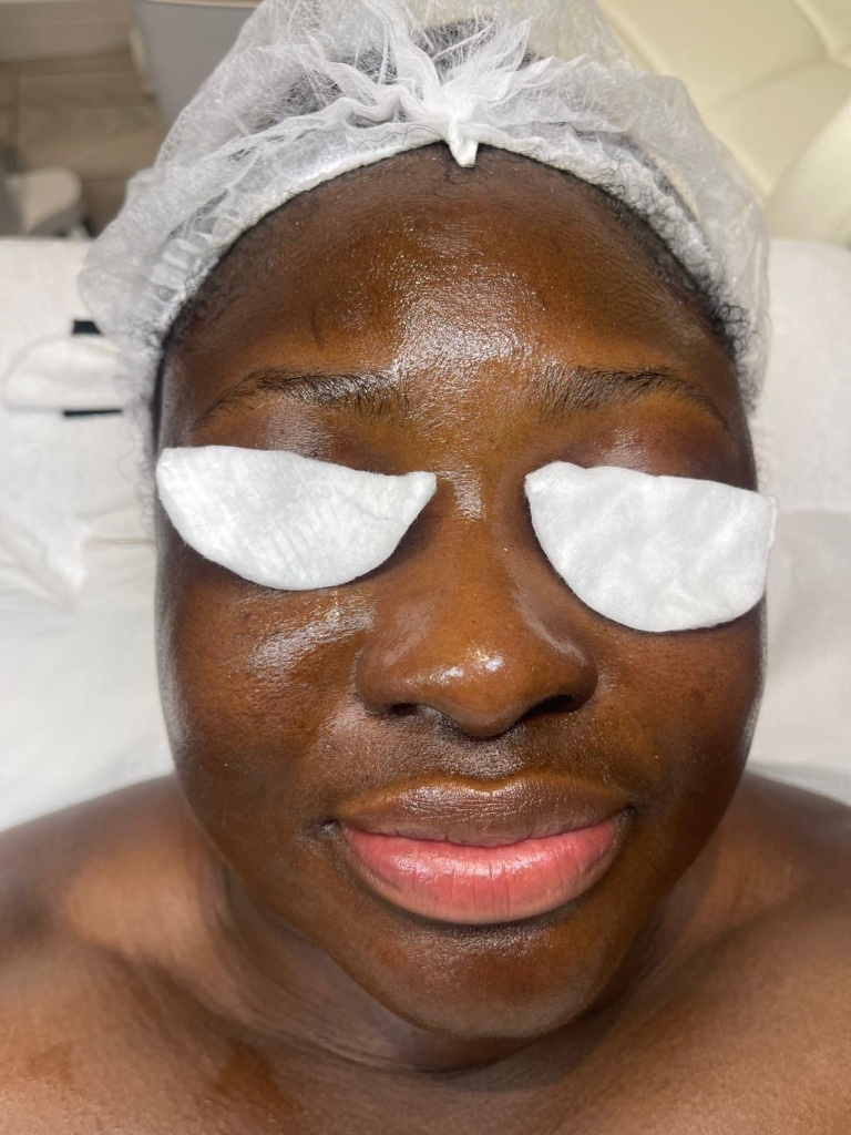 Skincare result