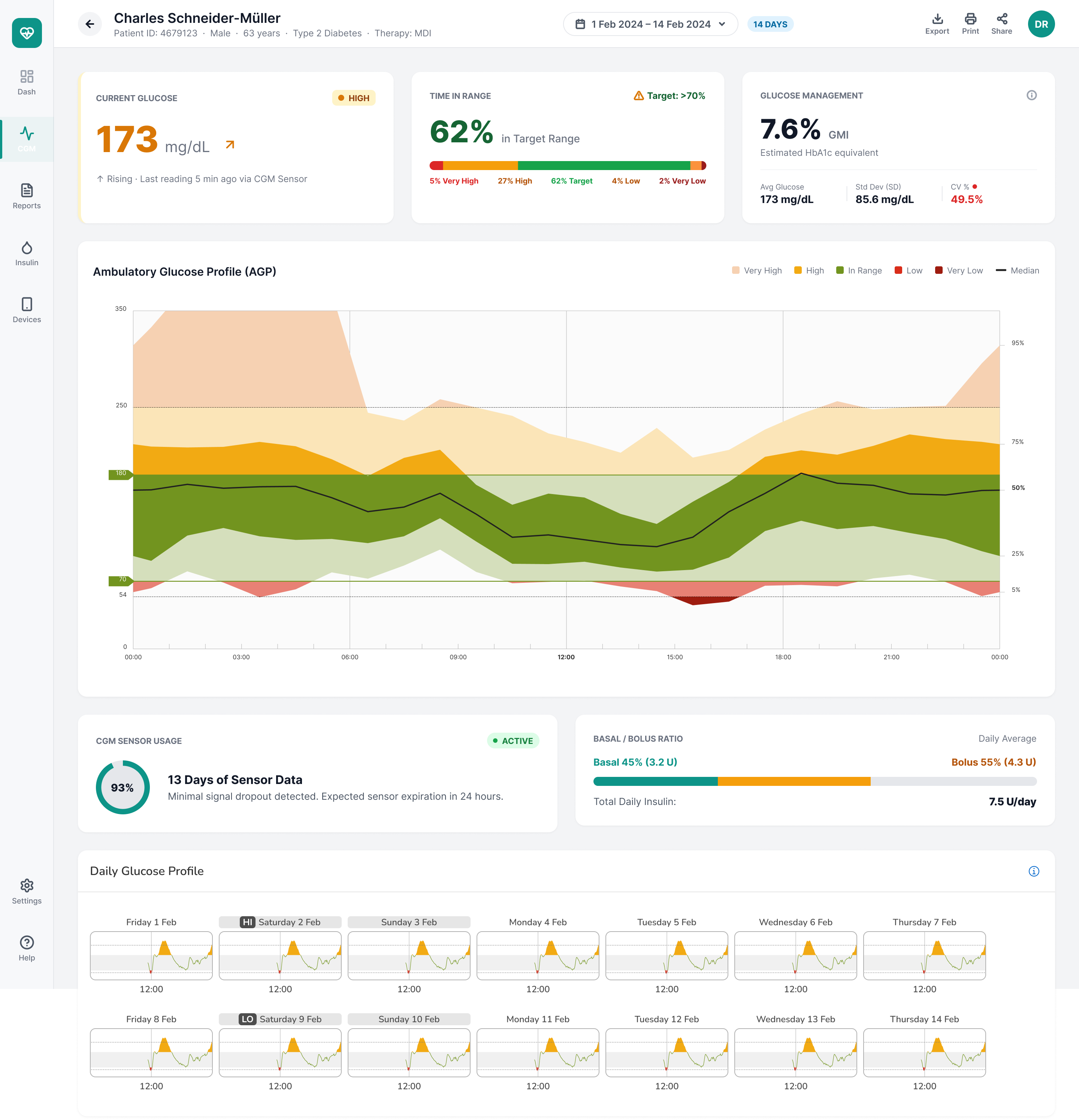 Clinical CGM dashboard, desktop version