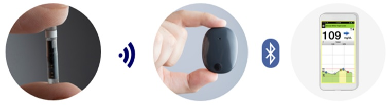 Eversense system components