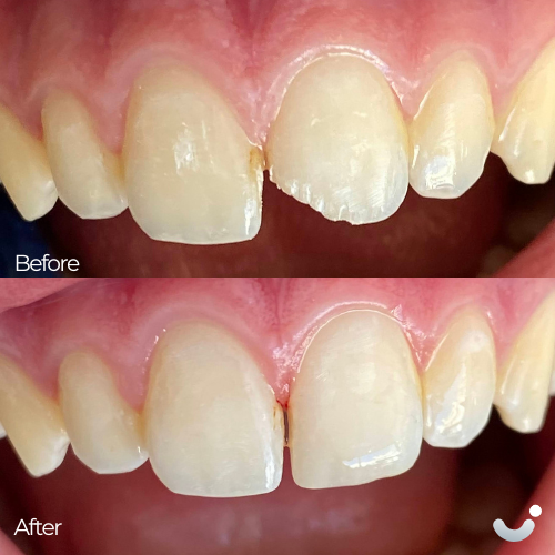 Before & After