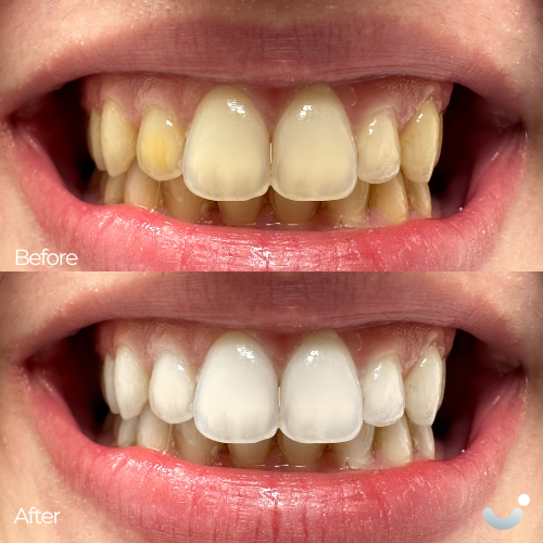Before & After