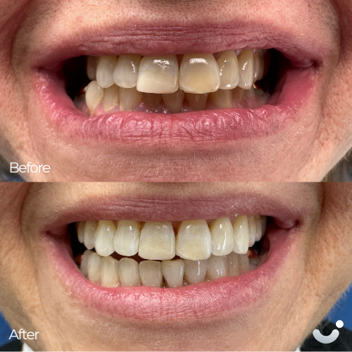 Before & After