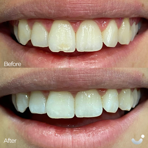 Before & After