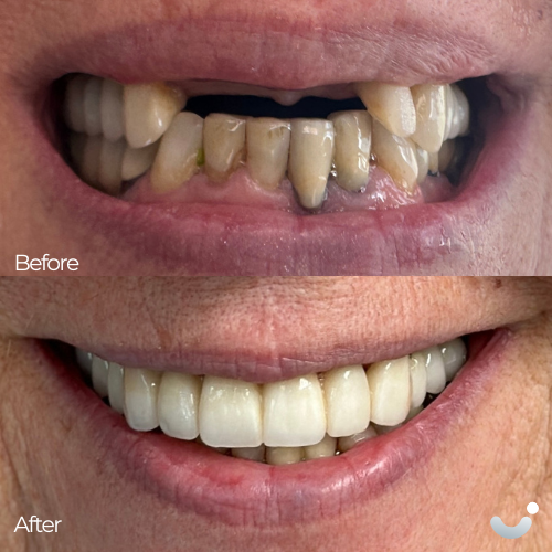 Before & After