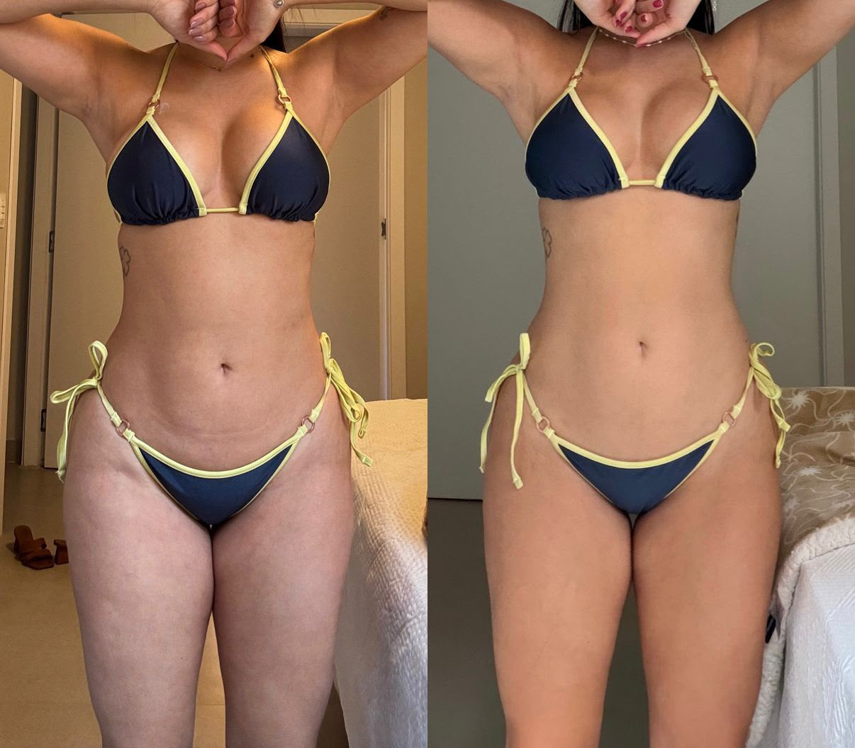 Antes e depois