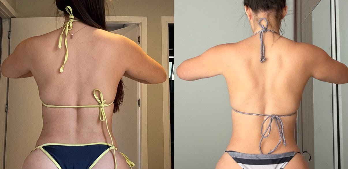 Antes e depois