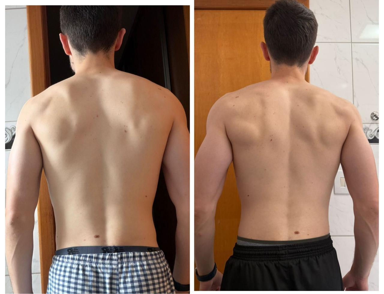 Antes e depois