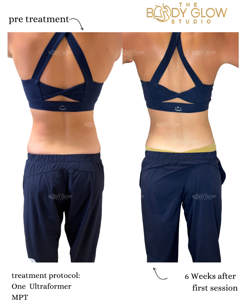 Back & Body