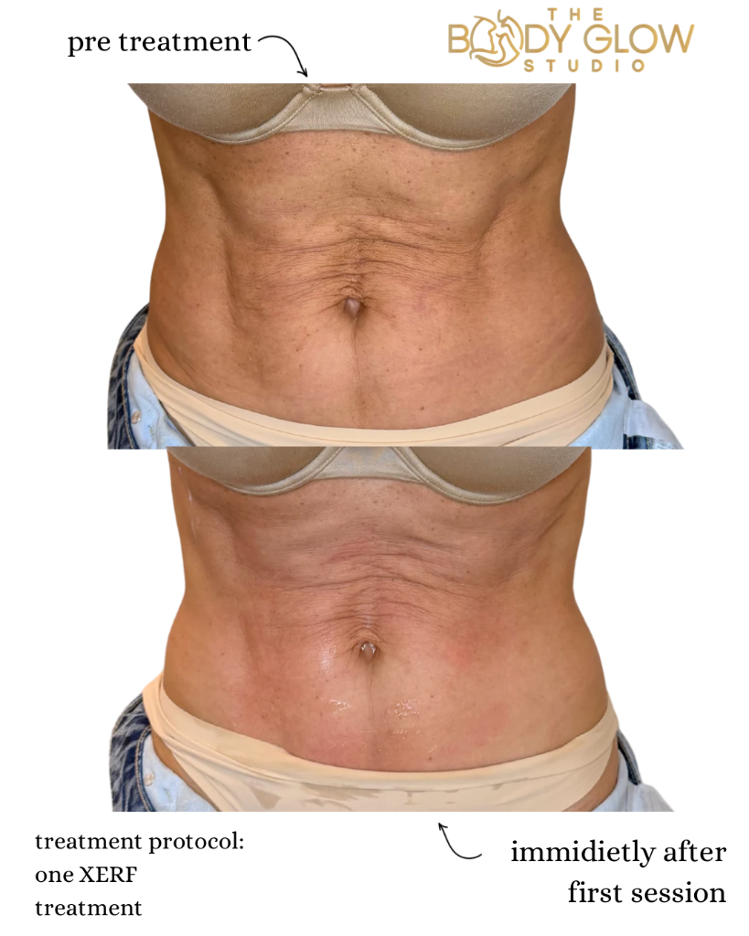 Stomach