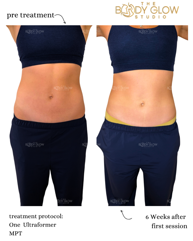 Stomach