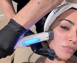 Kim Kardashian's Secret Skin Tightening Treatment — Now Available in Boca Raton