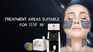"Ozempic Face" in Boca Raton: How to Restore Facial Volume & Tightness After GLP-1