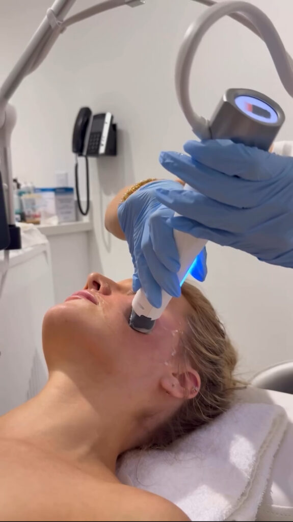 XERF vs Sofwave: Understanding the Differences in Non-Surgical Skin Tightening