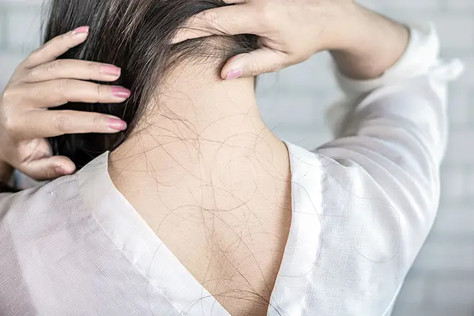 Hair Loss Caused by Stress: What Treatments Are Available