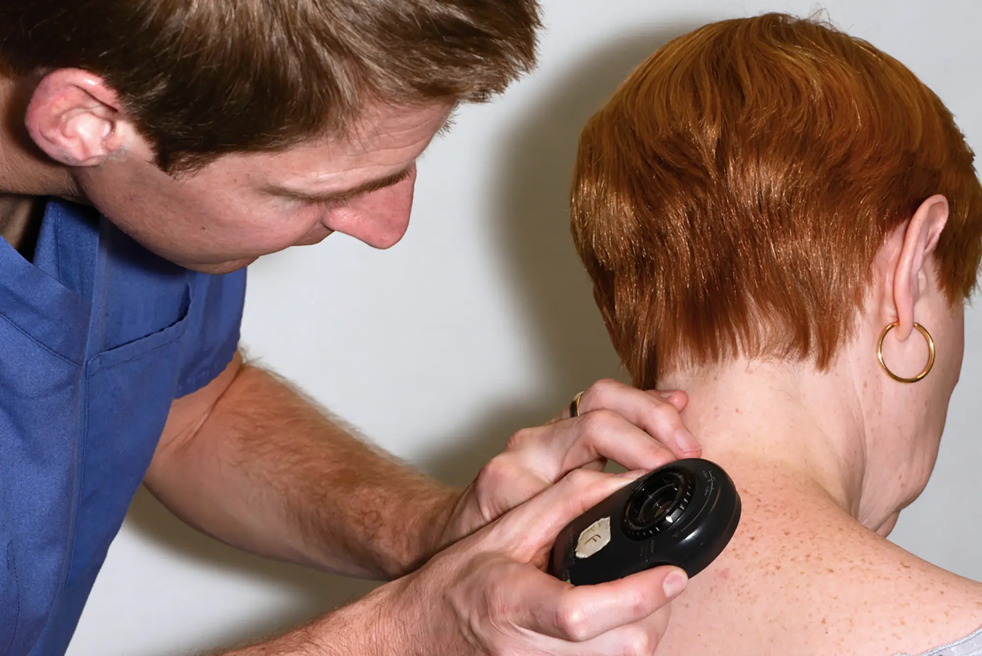 Mole Biopsy