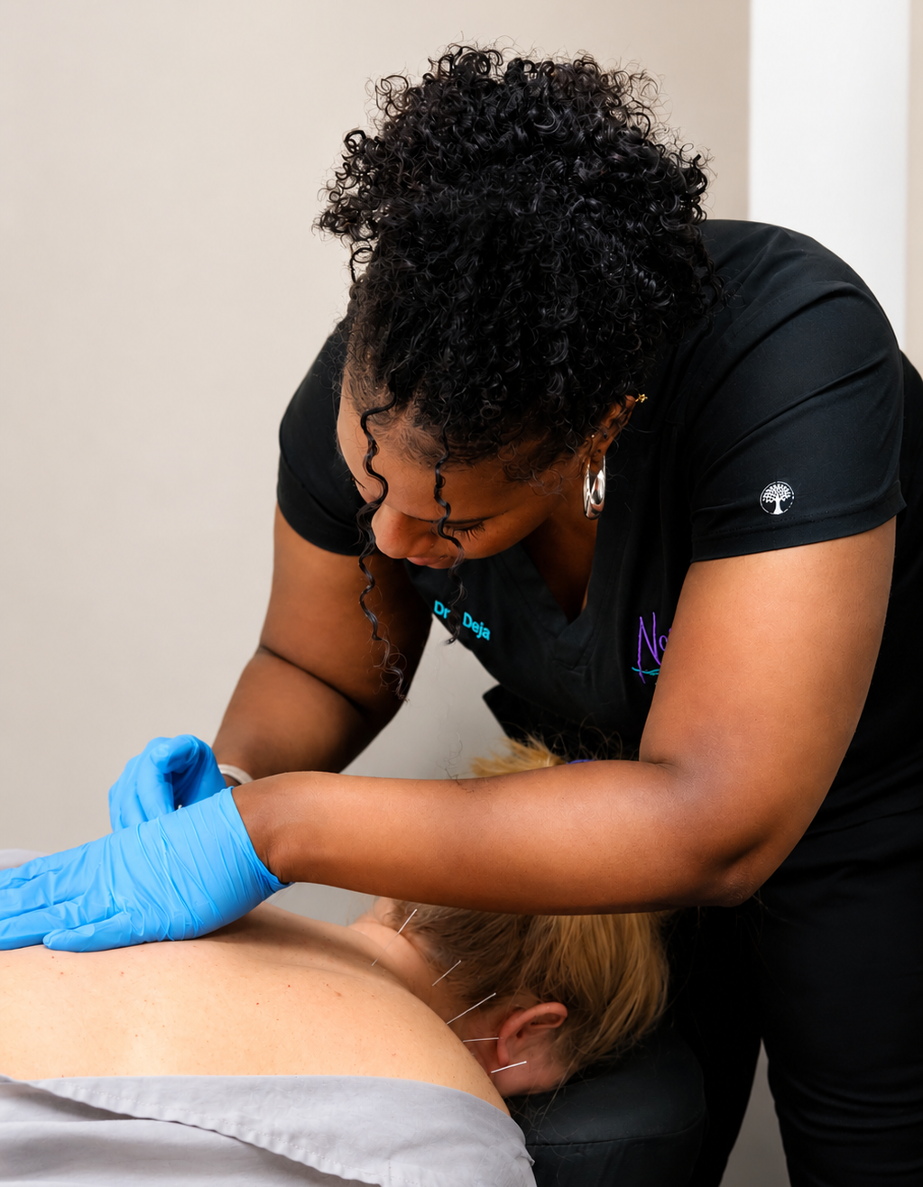 Dry needling treatment