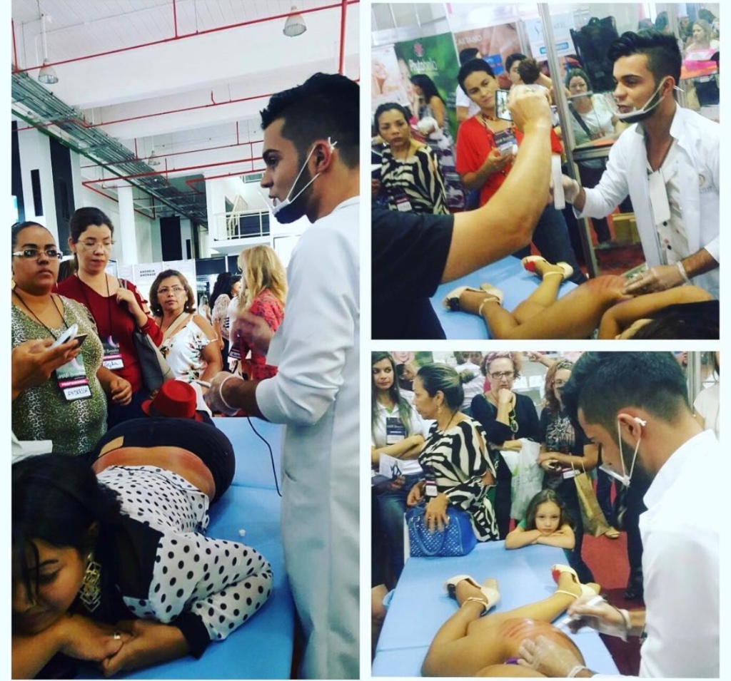 Exposição Protocolo para Estrias — Hair Brasília 2015