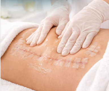 Specialized Post-Surgical Care