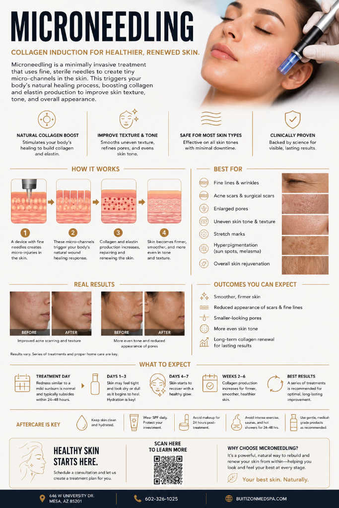Microneedling — Collagen Induction for Healthier, Renewed Skin: benefits, how it works, best for, results, timeline, and aftercare